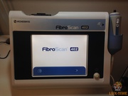 Аппарат FibroScan 402